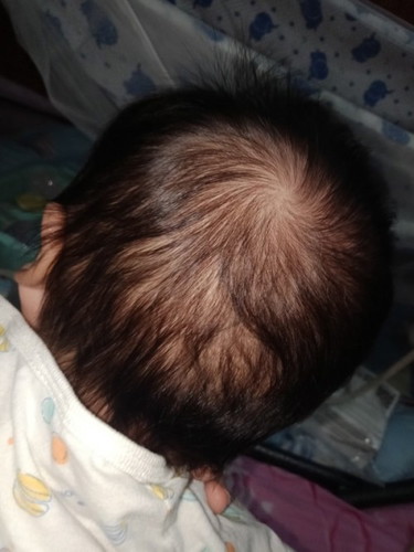 ไม่ได้โกนผมไฟค่ะ