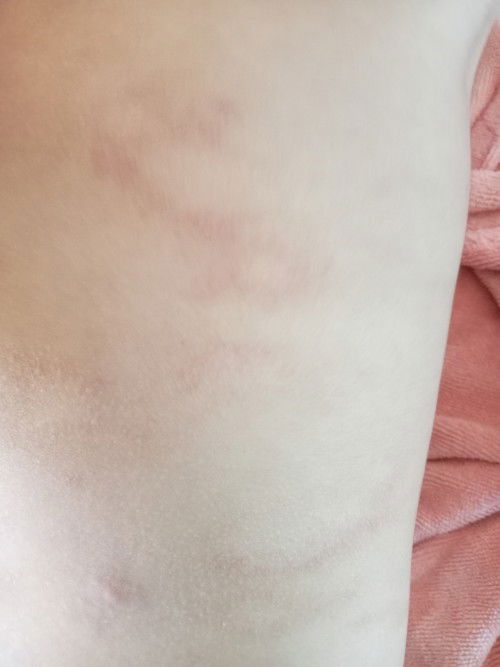 สอบถามผู้มีรู้หน่อย####ลูกบ้านใครเคยเป็นแบบนี้บ้างค่ะ######ขอคำแนะนำหน่อยค่ะ#######ขอขอบคุณมากๆๆค่ะ