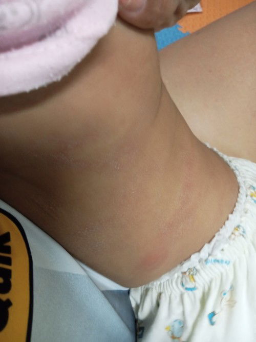 สอบถามหน่อยนะค่ะลูกบ้านใหนเคยเป็นแบบนี้บ้างค่ะ