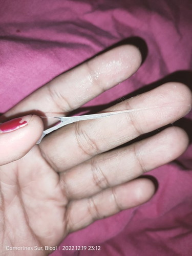 Sticky white discharge