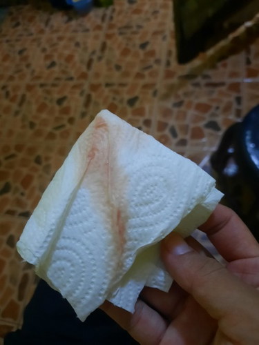 สอบถามแม่ๆค่ะ (ท้องแรกค่ะ)