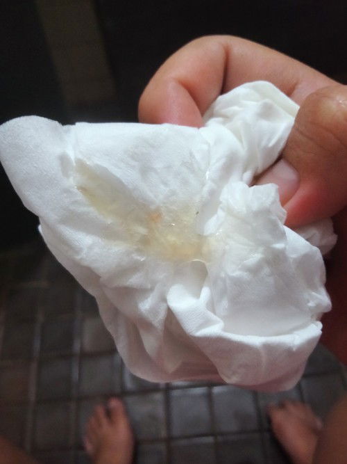 มูกใกล้คลอดรึยังคะ