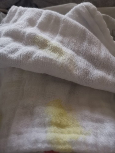 Mga mii,baka familliar po kau naglungad po baby ko ng color yellow nagwoworry ako 🥺 msma b ito?