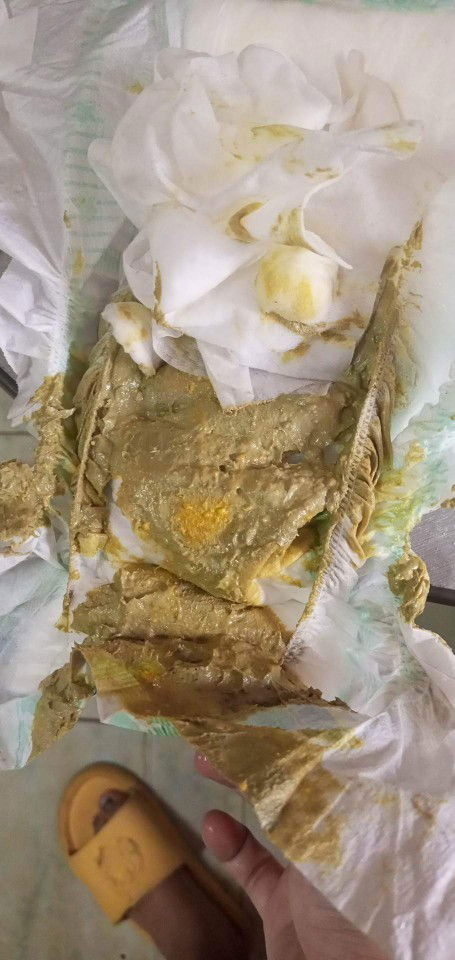 Papansin po mga momsh 
(First time mom)