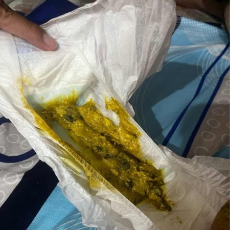 TAHI BINTIK HITAM + KUNING