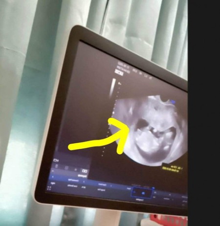nalulungkot ako gusto ko boy.