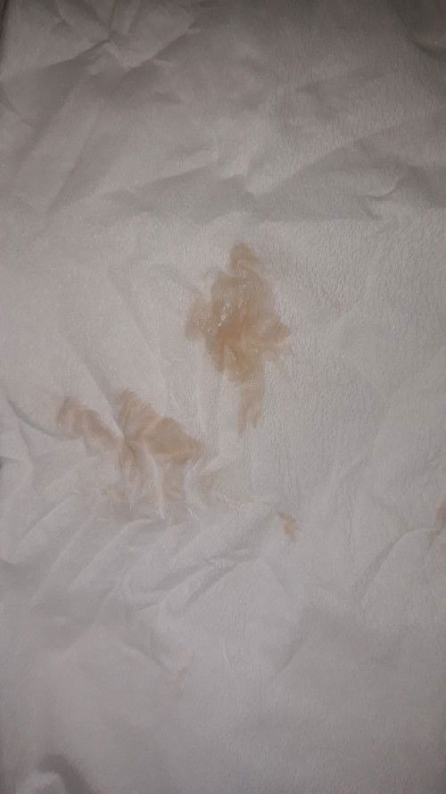 flek? atau keputihan?