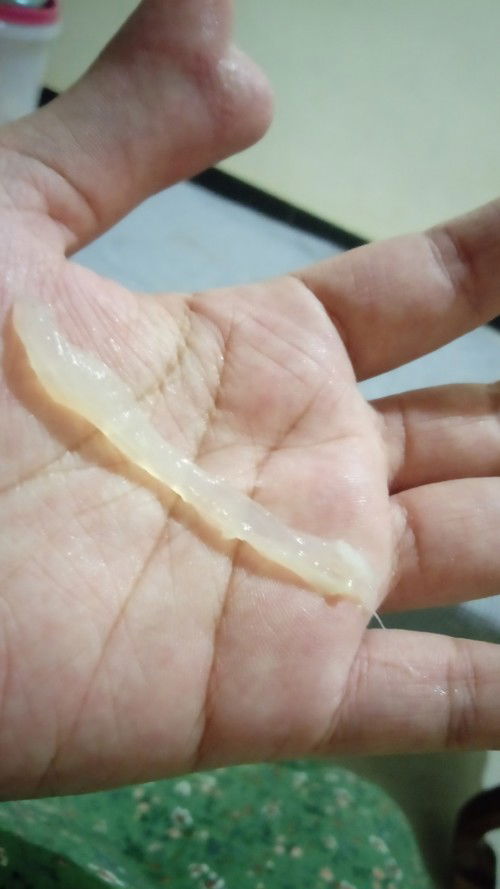 Hamil anak pertama nih bund