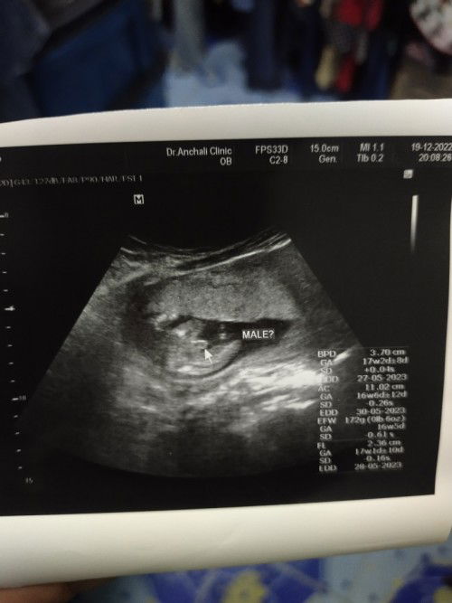 ลุ้นเพศลูก