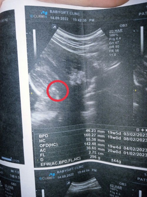 ขอสอบถามแม่ๆหน่อยคะ