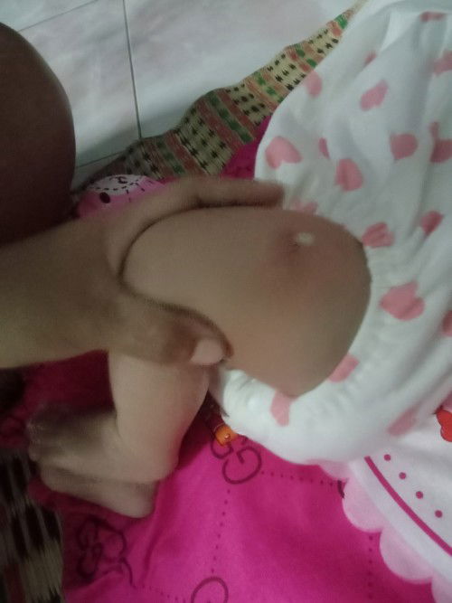 สอบถามแม่ๆหน่อยค่ะวัคซีน2เดือนใครเป็นแบบนี้บ้างสาเหตุเกิดจากอะไรค่ะ