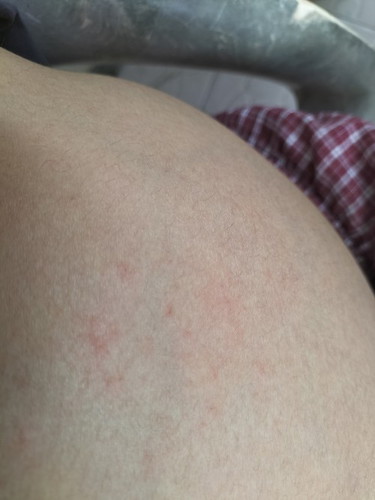 เป็นแบบนี้อันตรายมั้ยคะ
