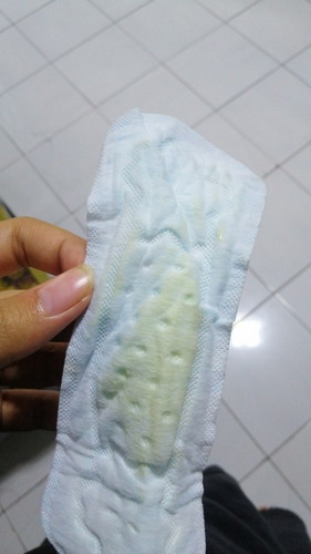Keputihan kuning Di 8bulan