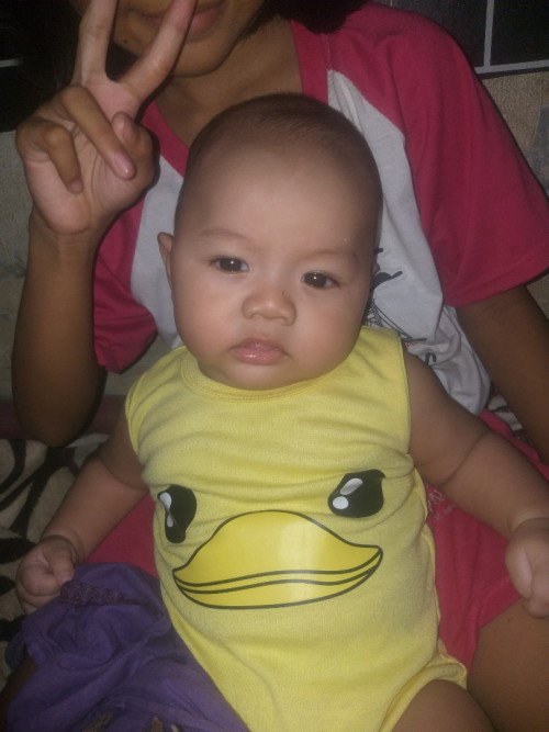 Kepala miring ke kiri