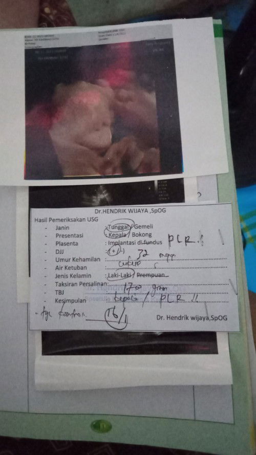 plasenta letak rendah