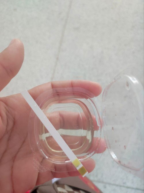 อยากสอบถามแม่ๆว่าตรวจขึ้นแบบนี้คือหมายความว่ายังไงคะ