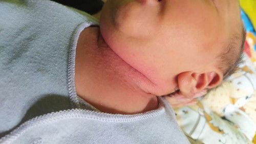 Ruam Susu
Mohon solusinya