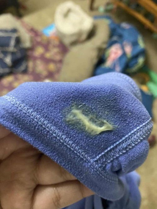 Bleeding selepas bersama