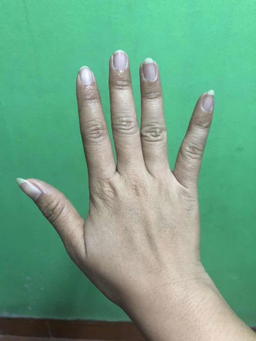 มีใครเป็นผื่นแบบนี้บ้างค่ะ