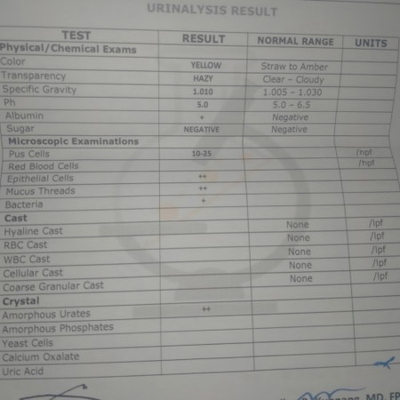 Urinalysis result