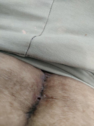 Ito po opera ko as of
now. Parang hindi po sya nababahaw... Any opinion po? Nov.15 po ako umanak.