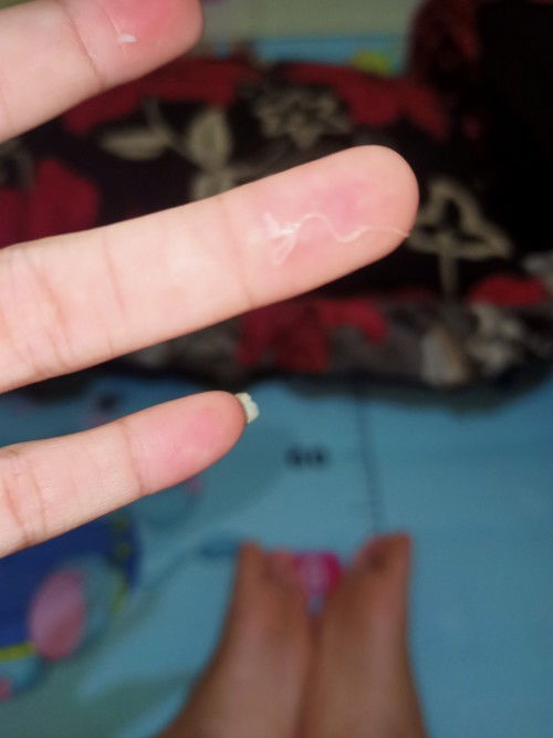 Keluar lendir kental