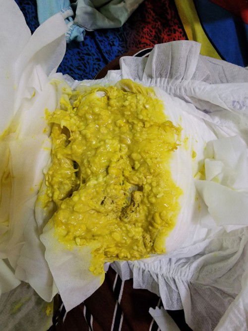 Ini berak biasa atau cirit berit?