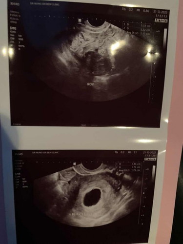 หมอบอกท้องลม