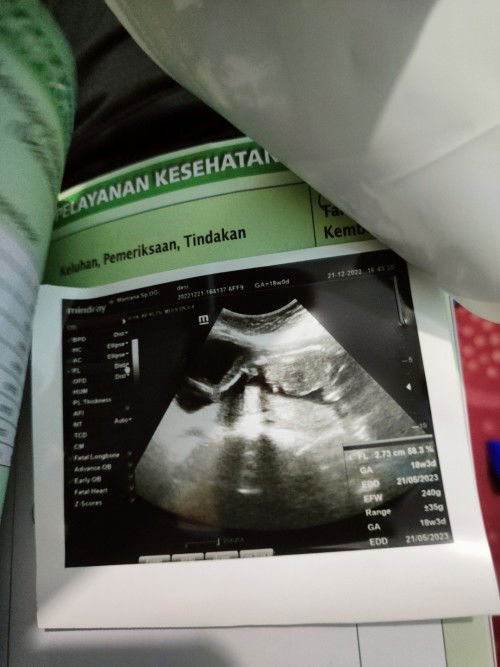 USG 18 minggu mau tanya