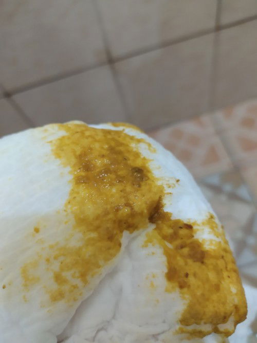 BAB lebih dari 3× dalam sehari