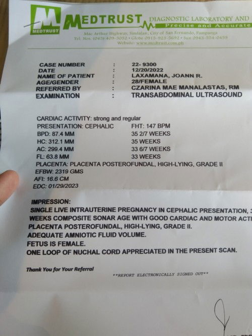 May chance puba na ms CS ako ONE LOOP NUCHAL CORD po kase si baby