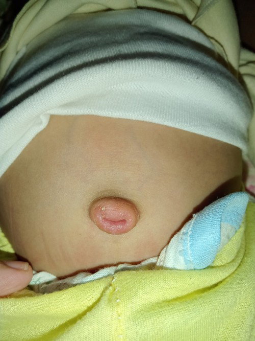 Puser bayi