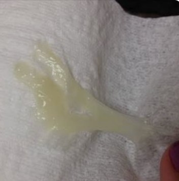 Light green discharge?