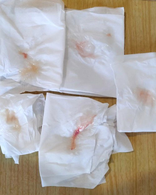 HPL 31 Des keluar lendir darah