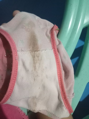 Pano po kaya pag nag spotting Ng ma brown tas ngayon eh mapink na natatakot po ako ehh