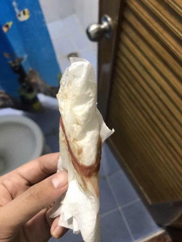 กระตุ้นปากมดลูก