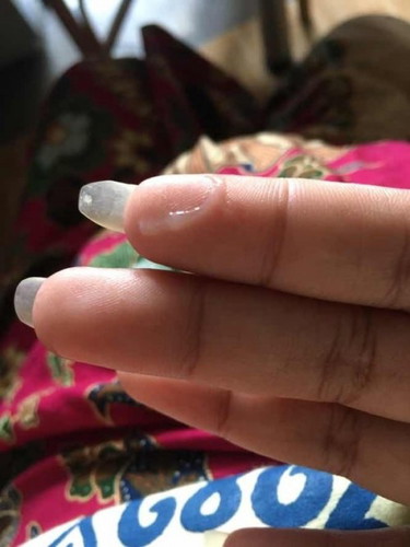 ขอบคุณสำหรับคำตอบค่ะ