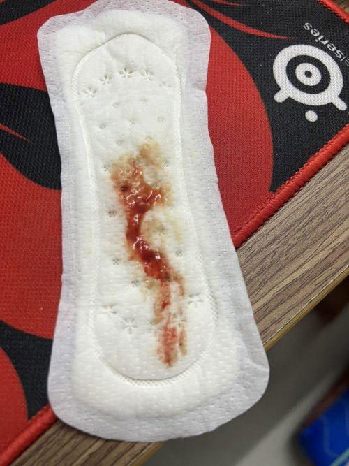 Bầu 39w4d xin ý kiến các mom