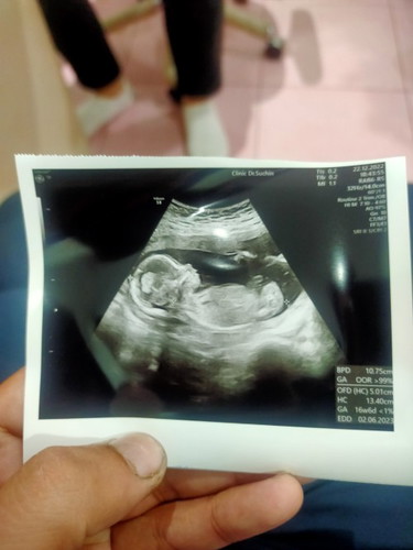 ขอสอบถามแม่ๆหน่อยค้า ใครพอจะมองออกบ้าง👶