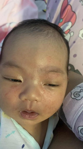 ลูกน้อย15วัน😂😂😂😂😂😂