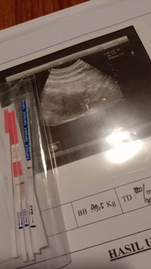 Agar janin berkembang sehat