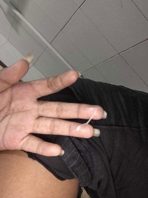 อันนี้มูกใสหรือตกขาวค่ะ ได้35w