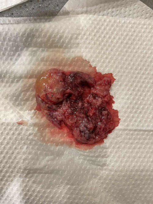 Berakhir kisah bakal seorang ibu