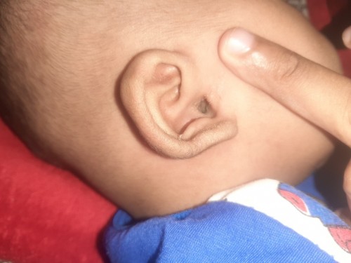 Telinga anak saya umur 4 bulan berair hijau keabuan tapi tidak bau kenapa ya bun? Ada solusinya?