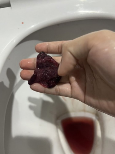 ขออภัยหากไม่ไม่สุภาพ