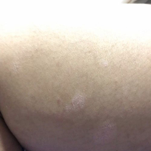 ถามเเม่ๆหน่อยจ้า