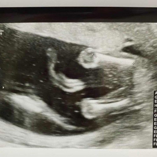 สอบถามแม่ๆค่ะ