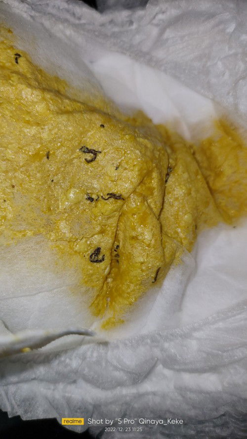 sakit apa yah dedek ..