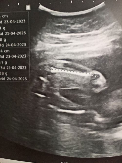 ช่วยดูเพศลูกหน่อยค่ะ