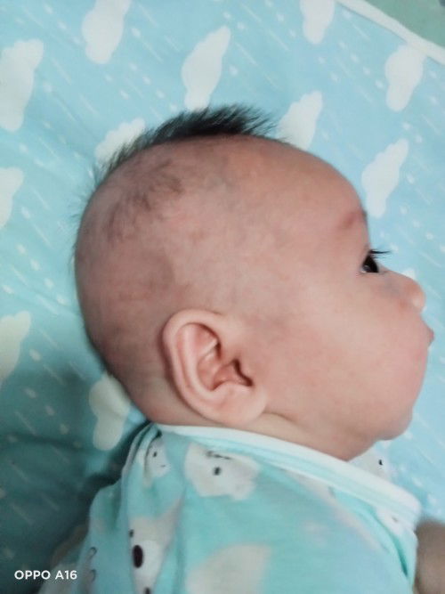 ขอคำปรึกษาเกี่ยวกับศีรษะลูกหน่อยค่ะ